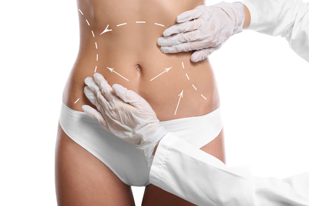 Different types of liposuction and their procedure