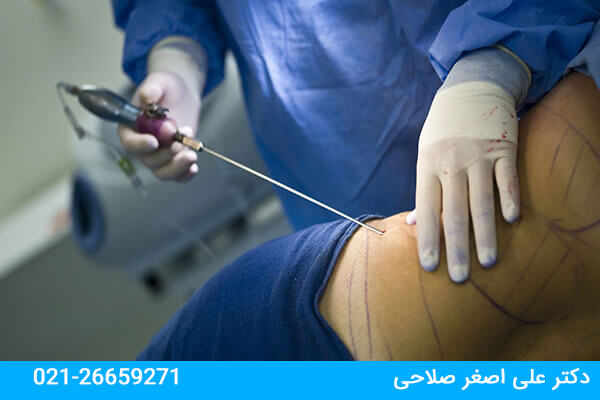 لیپوماتیک چیست؟ آشنایی با لیپوماتیک